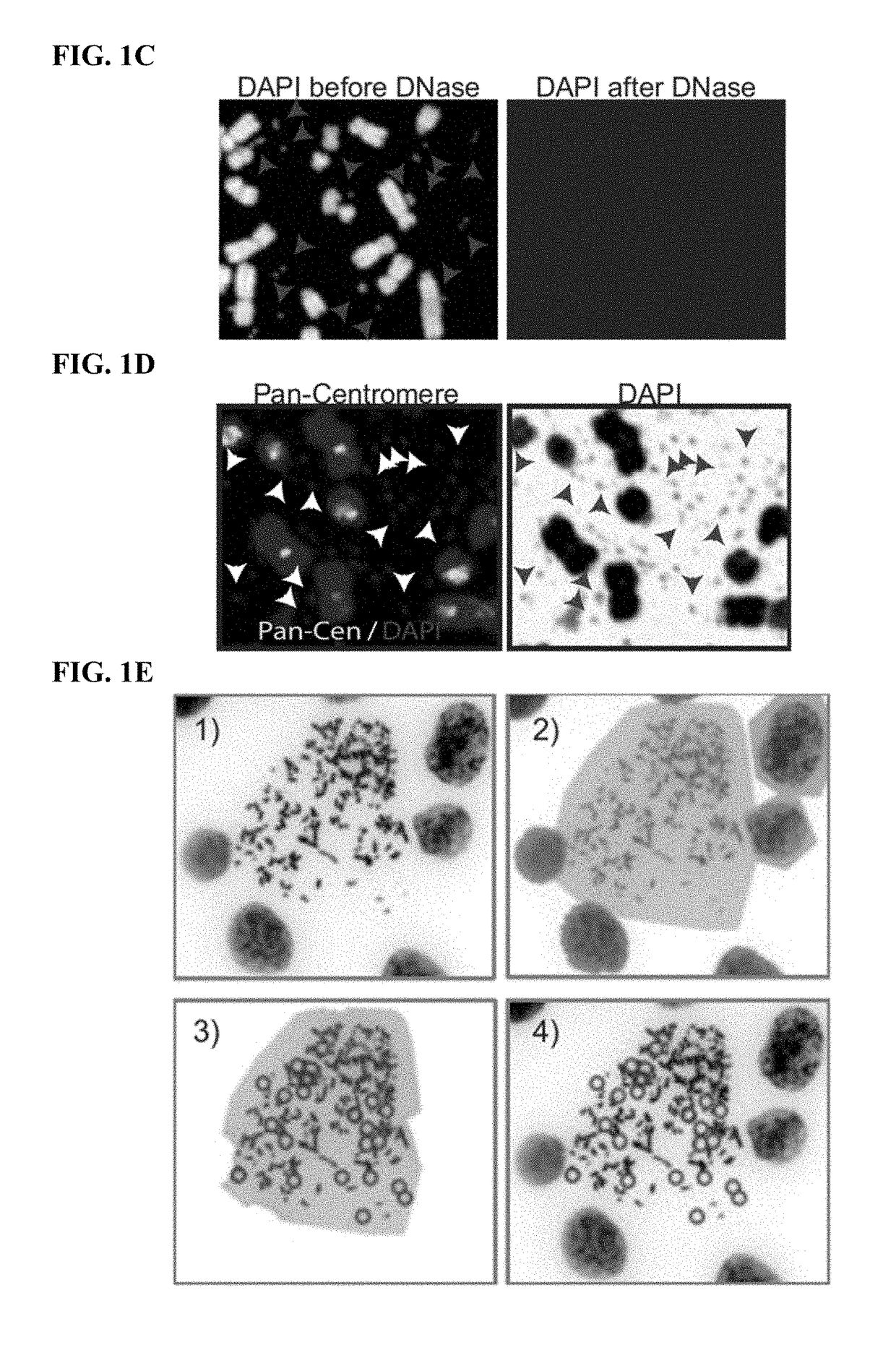 Methods of diagnosing and treating cancer targeting extrachromosomal DNA