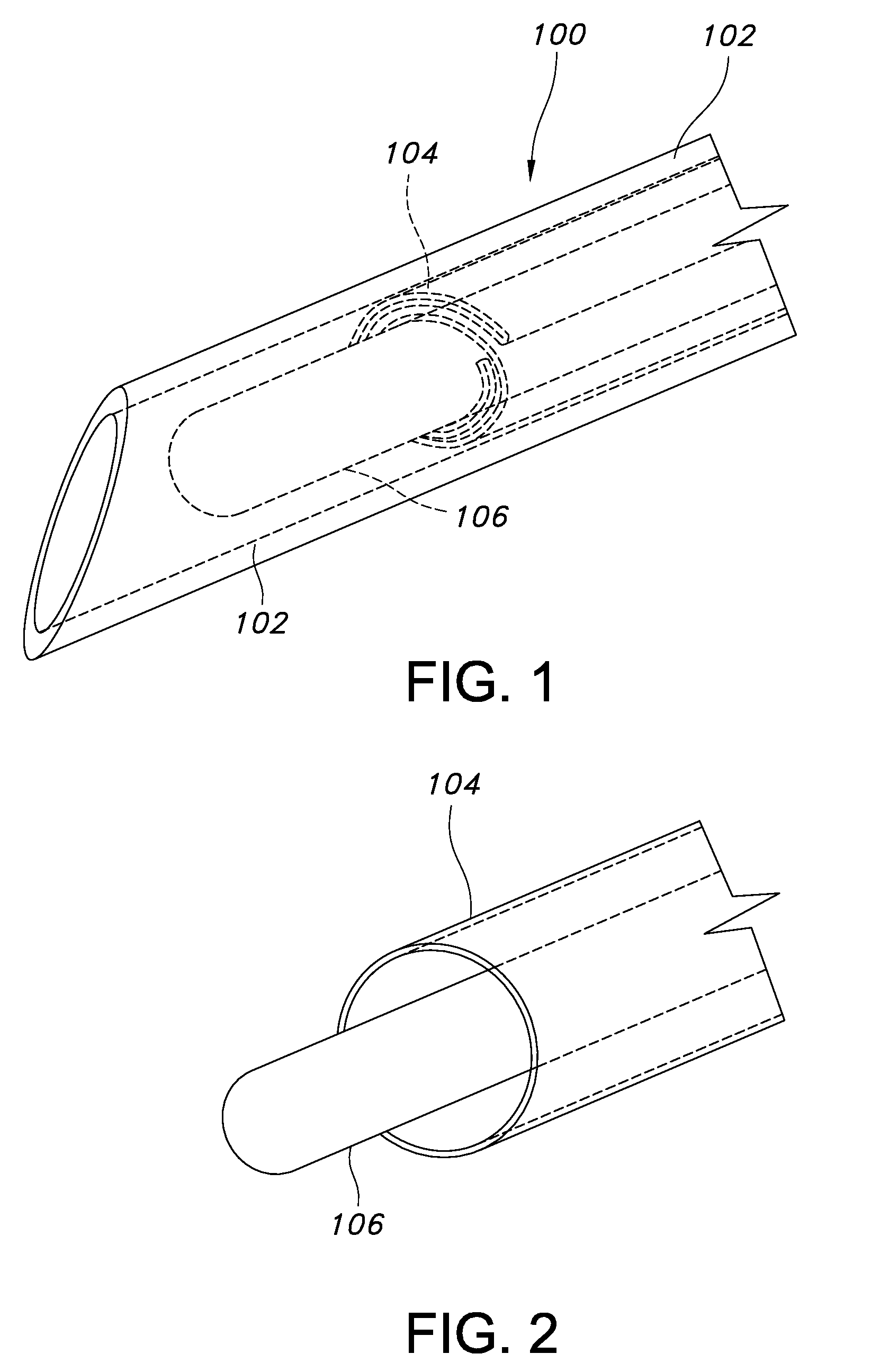 Expandable dialysis apparatus and method