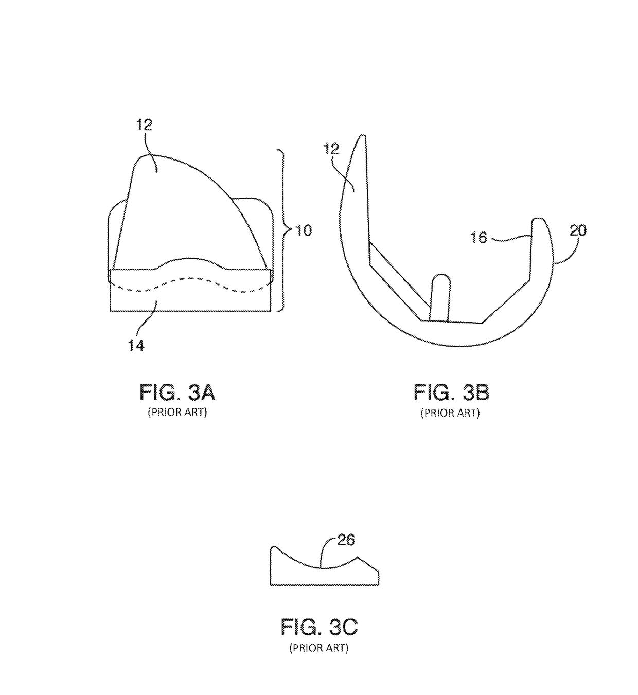 Systems and methods for providing prosthetic components