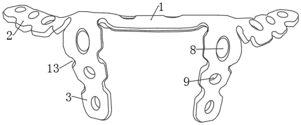 Novel symphysis pubis dissection bone fracture plate and design method thereof