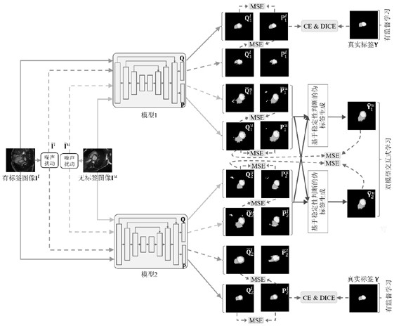 Semi-supervised medical image segmentation method and device based on dual-model interactive learning