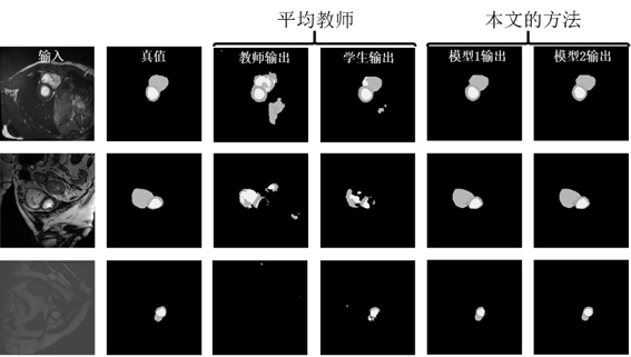 Semi-supervised medical image segmentation method and device based on dual-model interactive learning