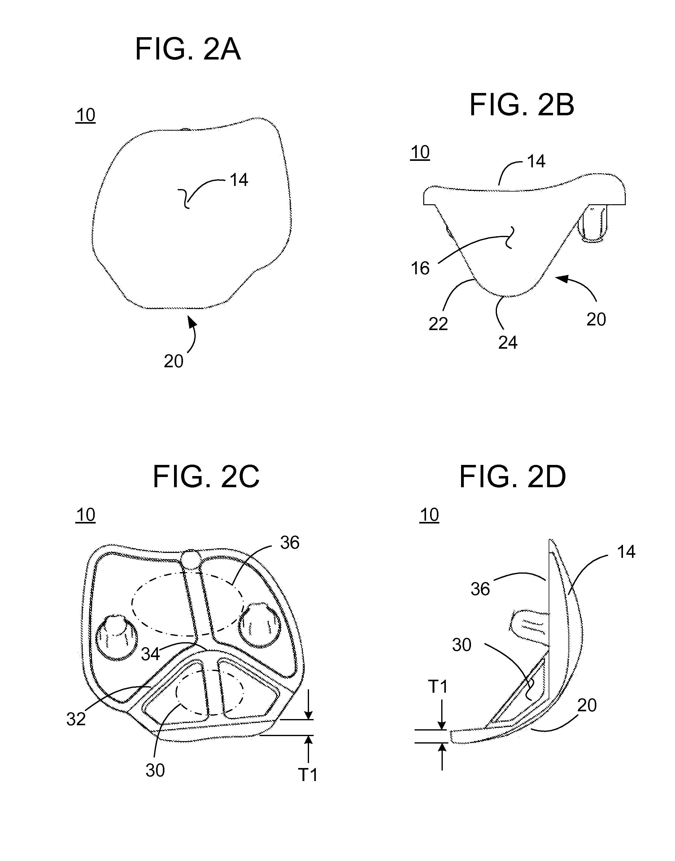 Methods And Apparatus For Preparing a Patient's Femur For Patellofemoral Knee Arthroplasty