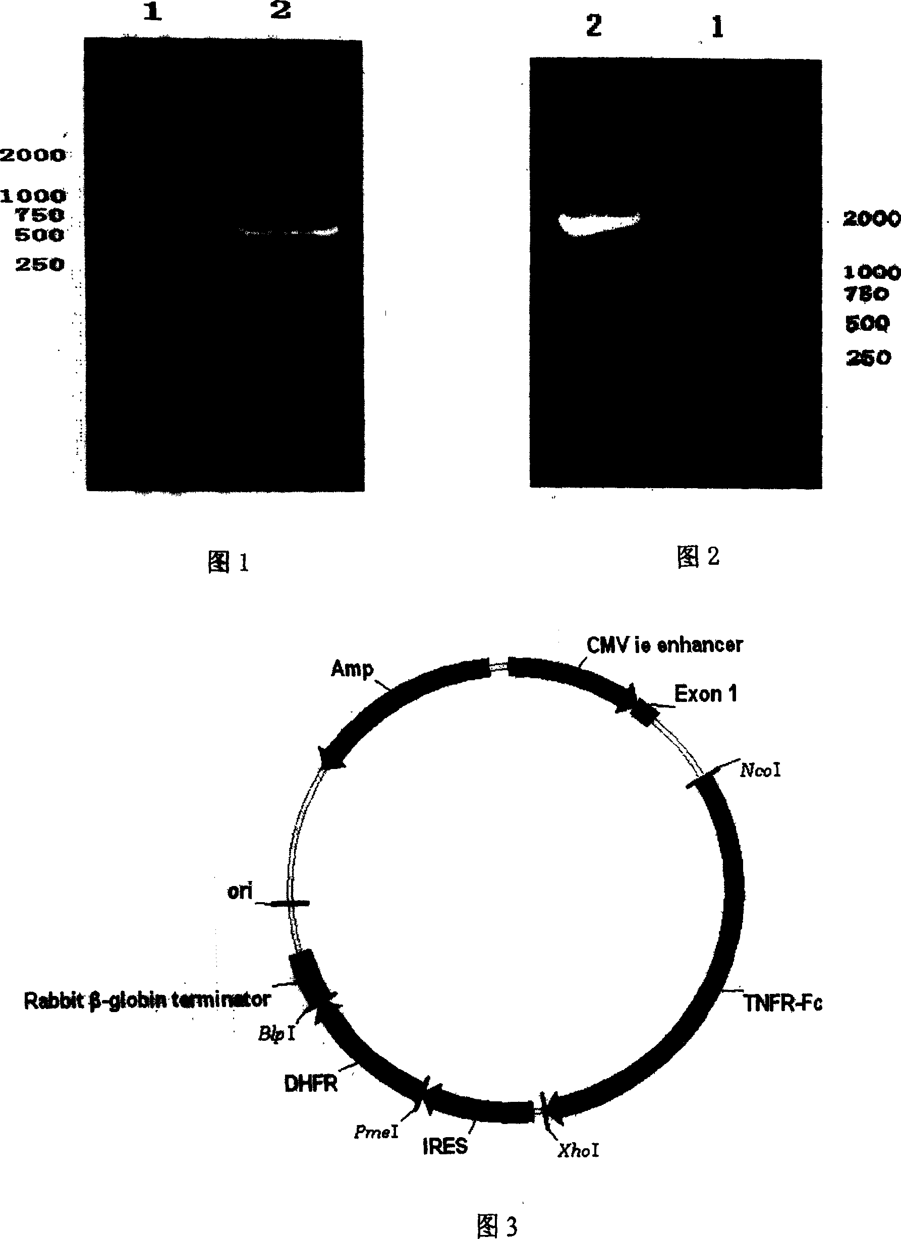 Fusion protein in soluble receptor II - antibody Fc section of human tumor necrosis factor