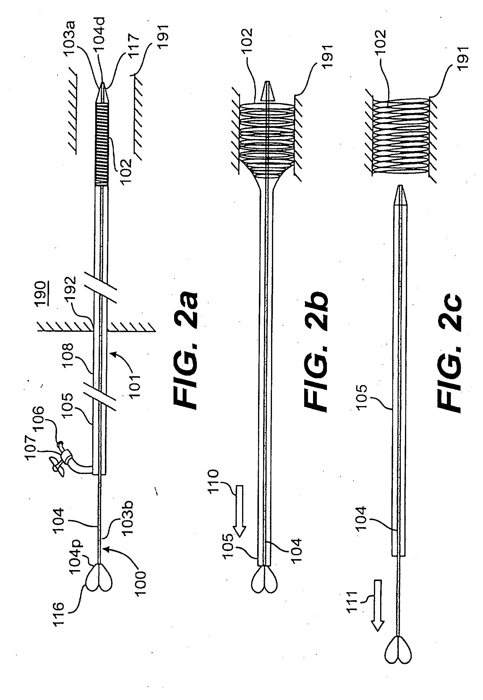 Endoscopic stent delivery system and method