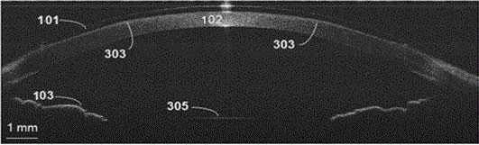 OCT imaging system and method for monitoring shaping effect of orthokeratology lens in vivo