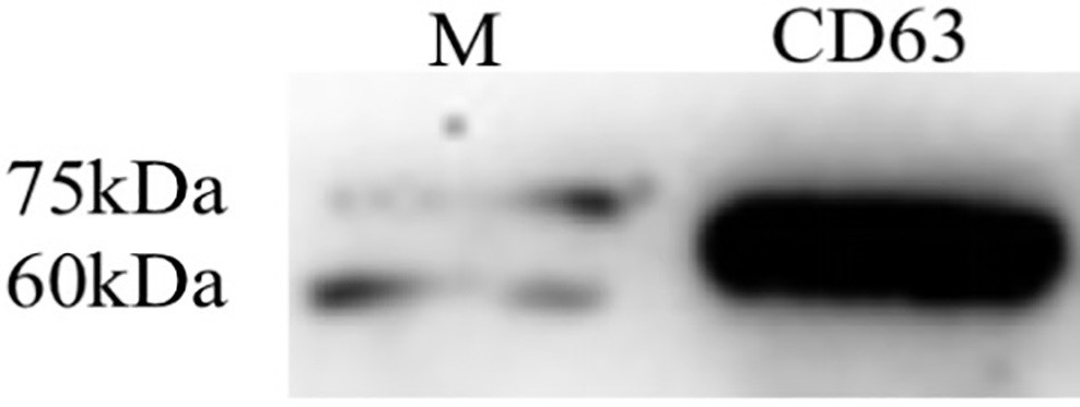 ELISA (Enzyme-Linked Immunosorbent Assay) detection method of avian exosome
