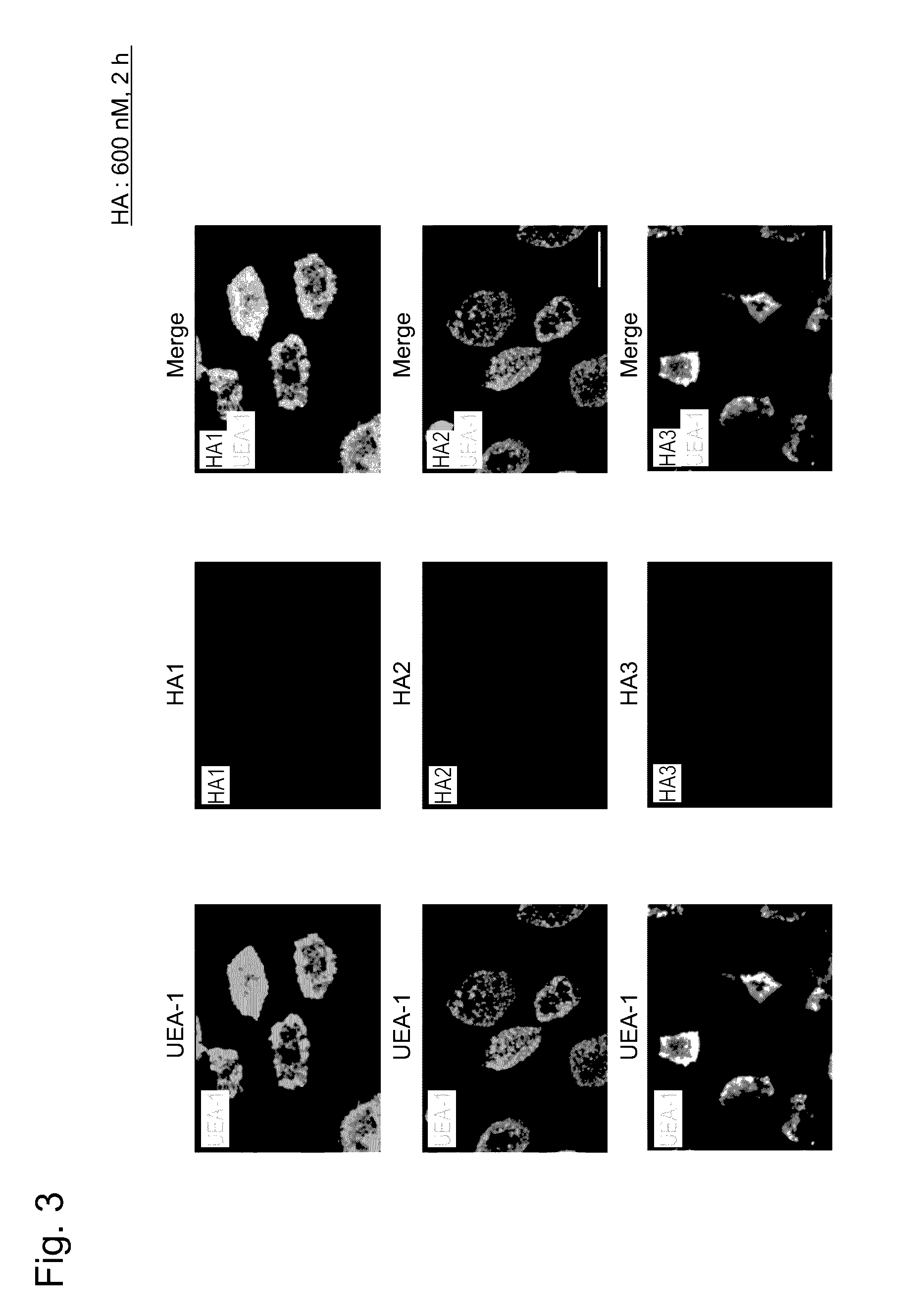 Adjuvant for mucosal vaccine