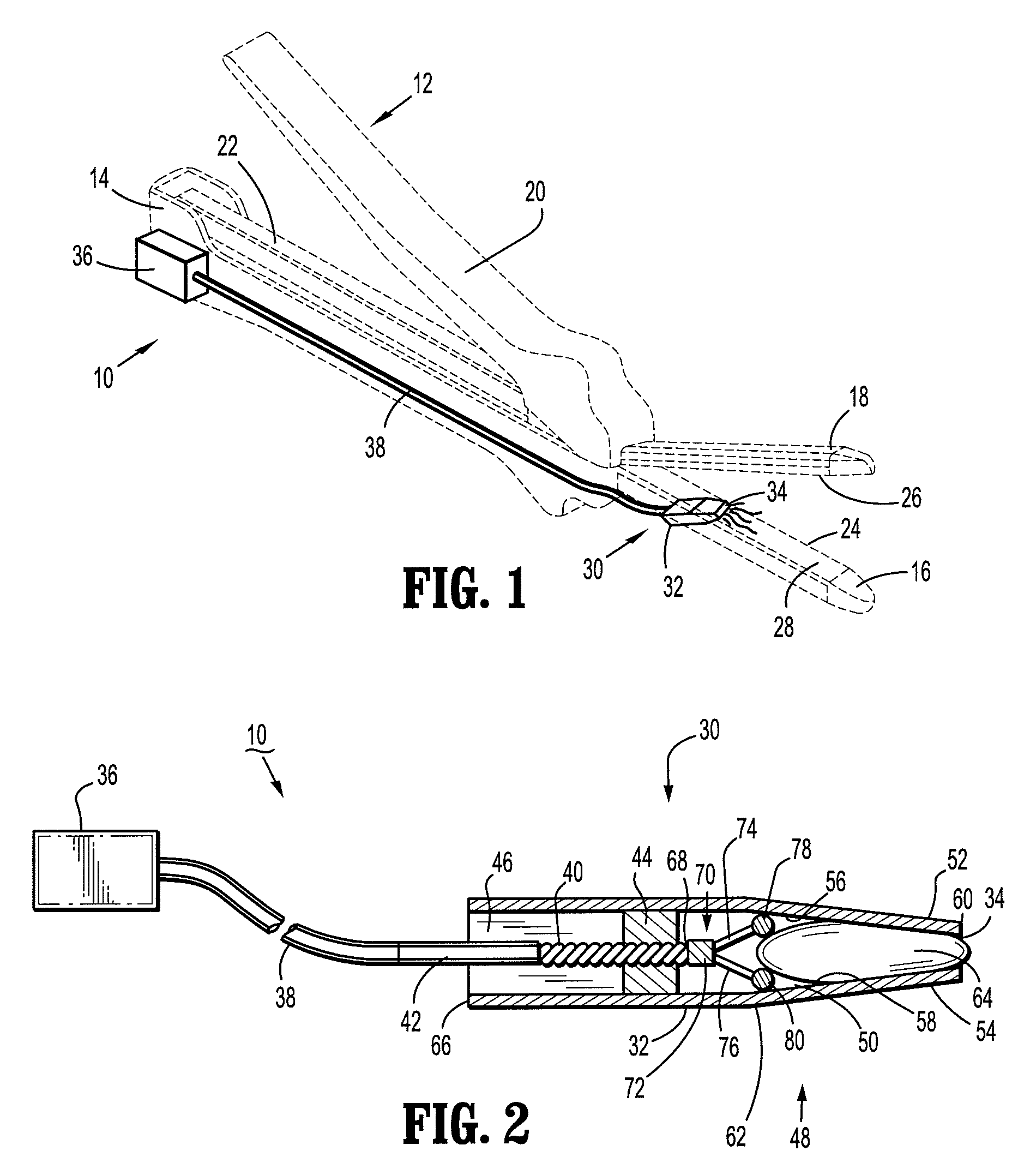 Stapler powered auxiliary device for injecting material between stapler jaws