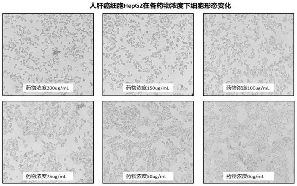 Application of a bacillus subtilis amep412 protein in inhibiting tumor cell proliferation