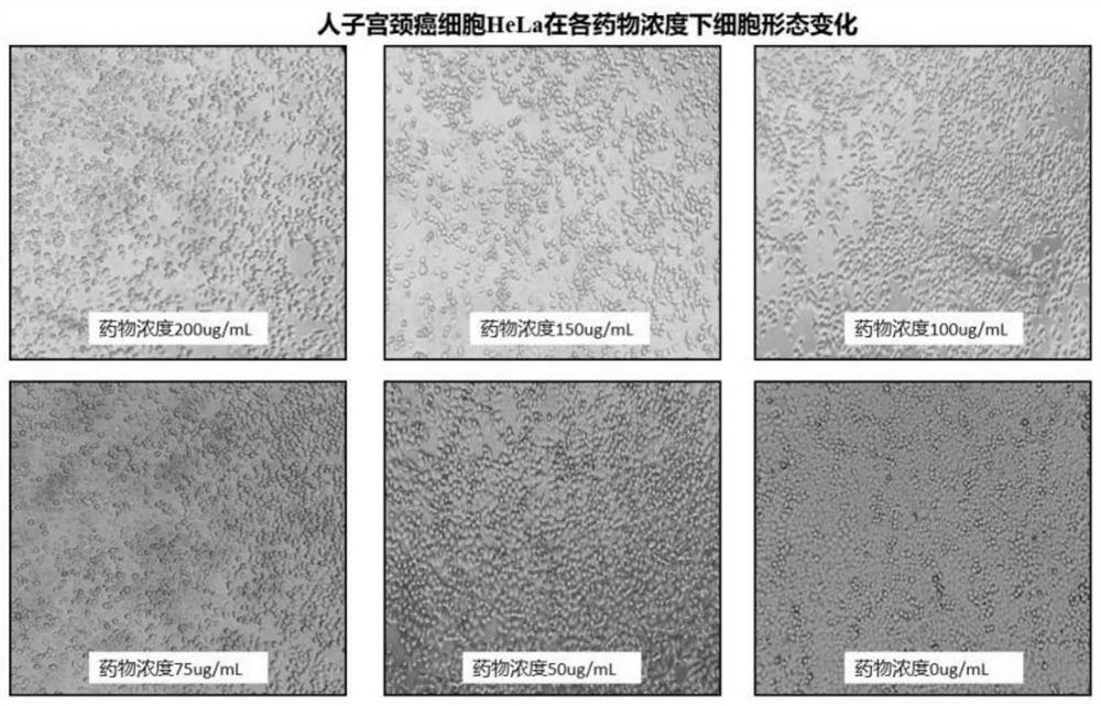 Application of a bacillus subtilis amep412 protein in inhibiting tumor cell proliferation