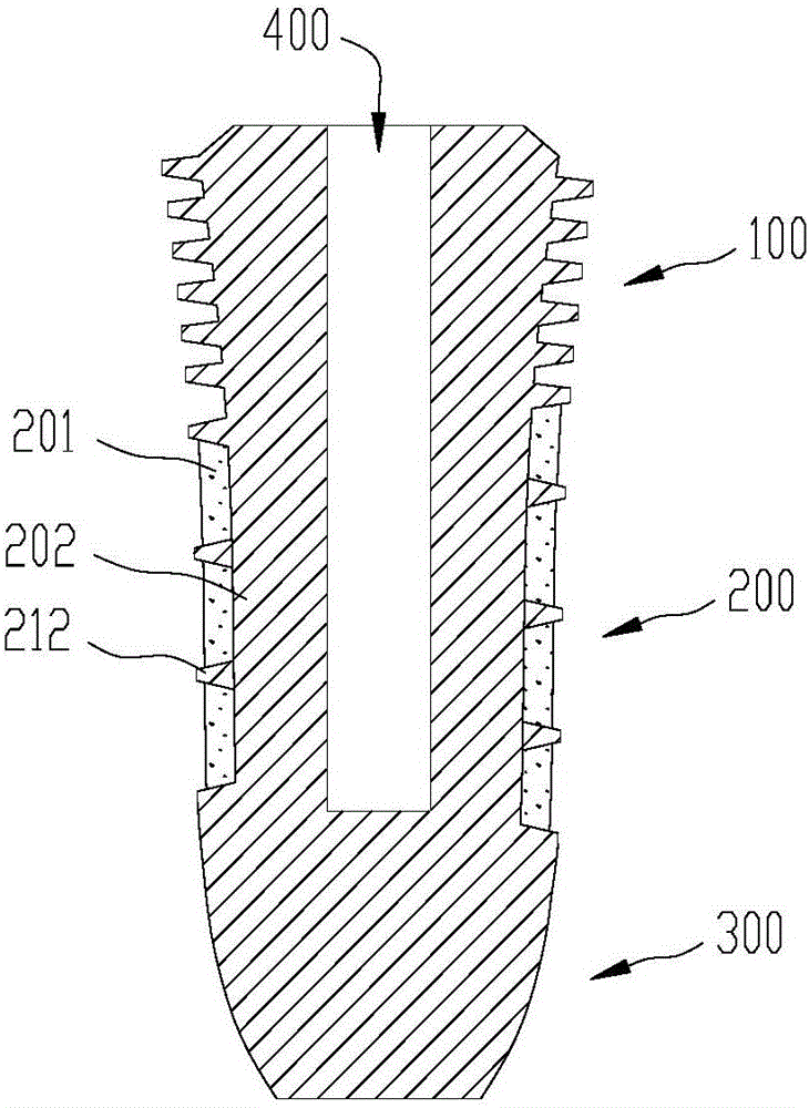 Dental implant and preparation method thereof