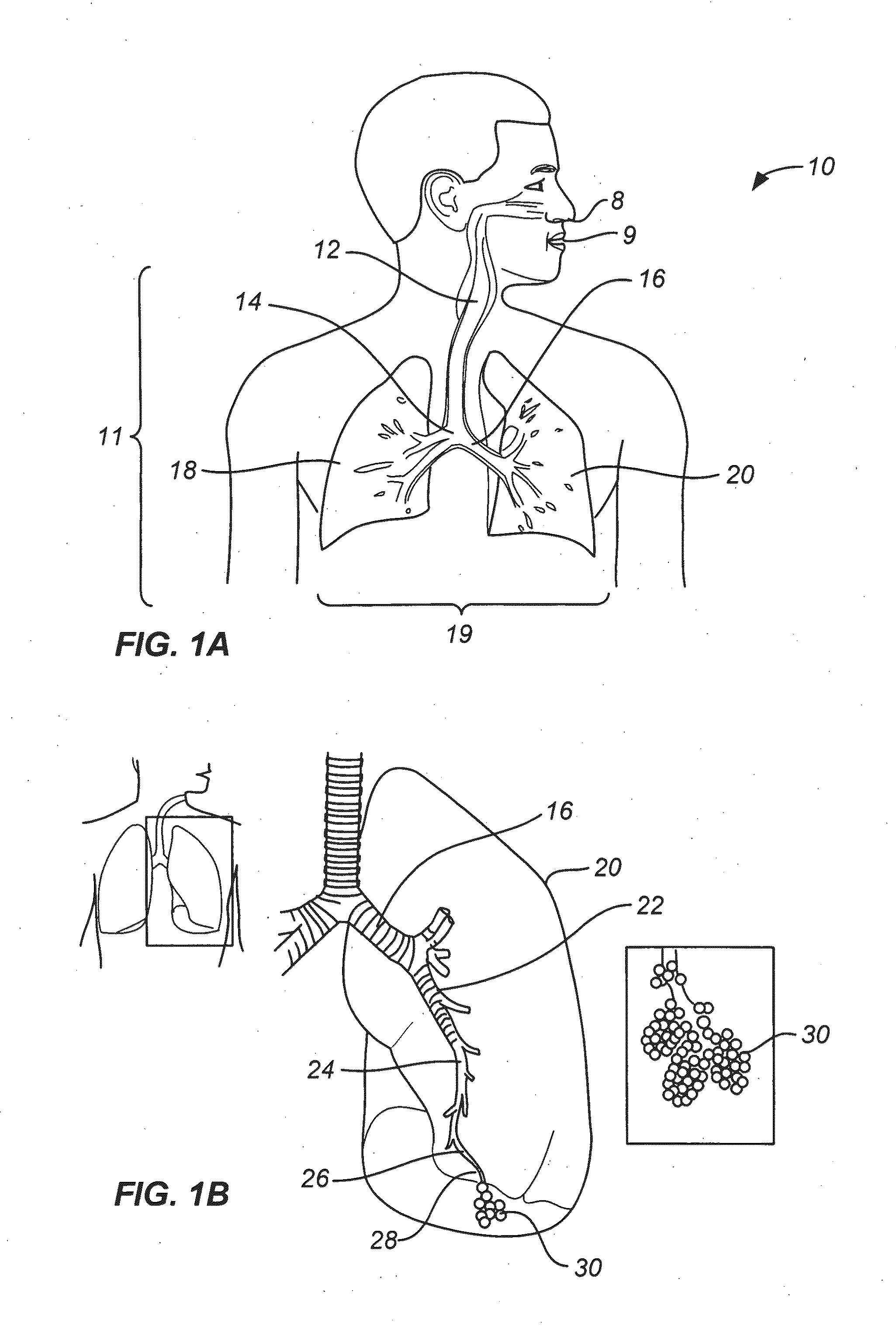 Steerable device for accessing a target site and methods