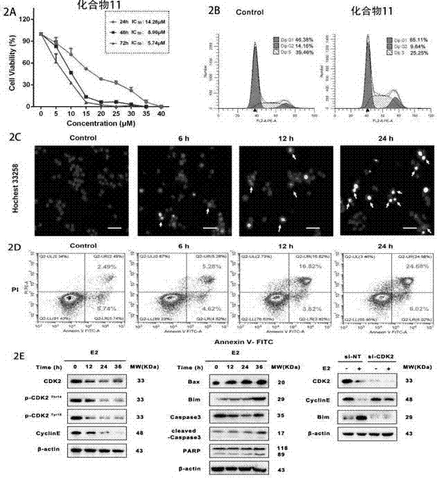 Novel CDK2 inhibitor and application thereof in resisting of breast cancer