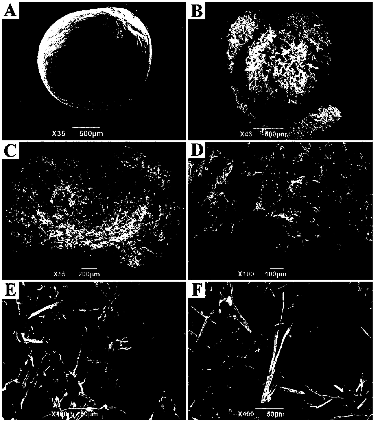 Preparation method for colon-targeted slow-release Ibuprofen microsphere