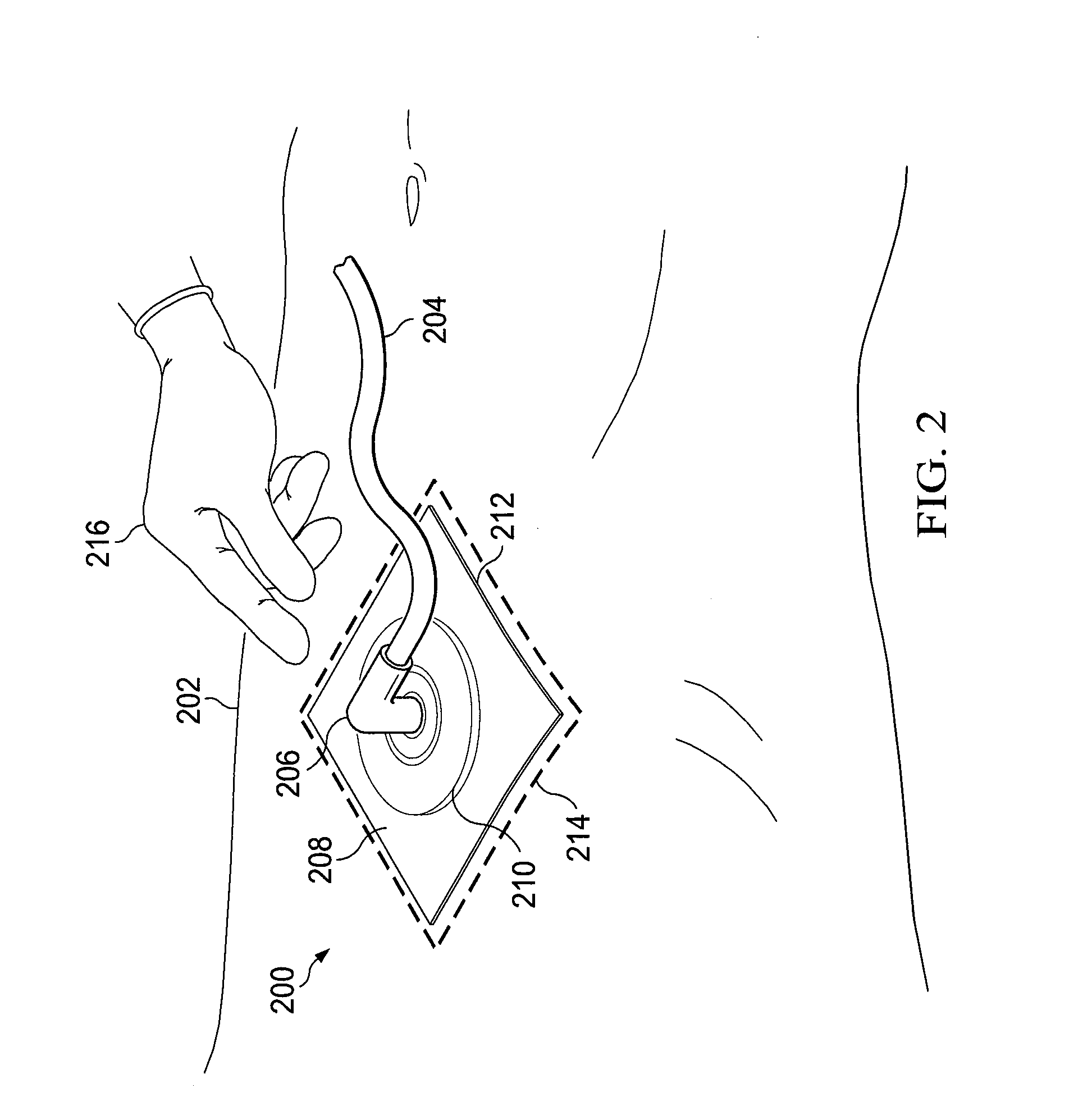 System and method for locating fluid leaks at a drape using sensing techniques