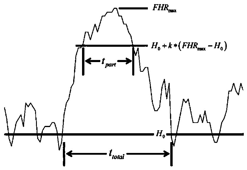 Non-baseline part of fetal heart rate curve and calculation method of baseline