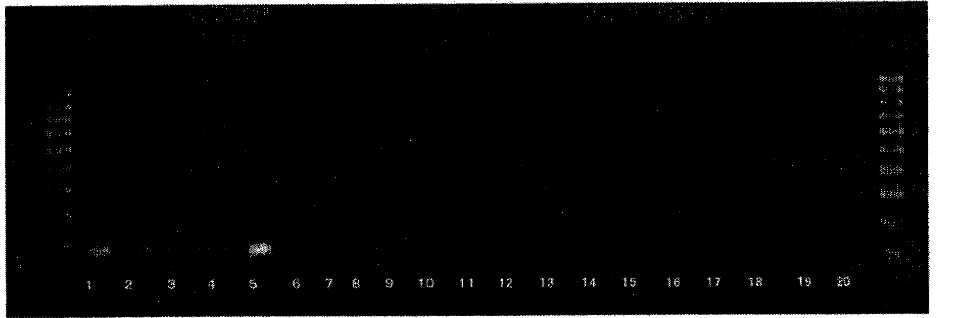 Method for detecting bacterium belonging to genus geosmithia