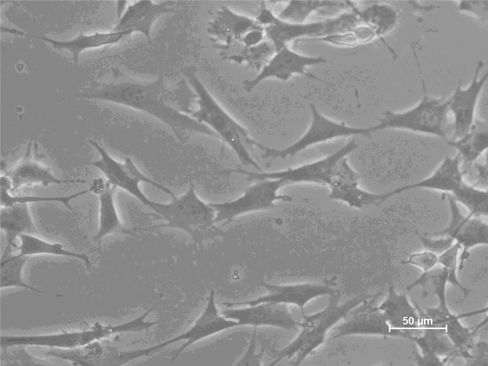 Mouse fibroblast tumor cell strain HXLyAF-KBM and application thereof