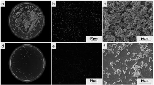 Degradable anti-infection lithiasis-preventing Fe-Cu series alloy applicable to urinary implant material