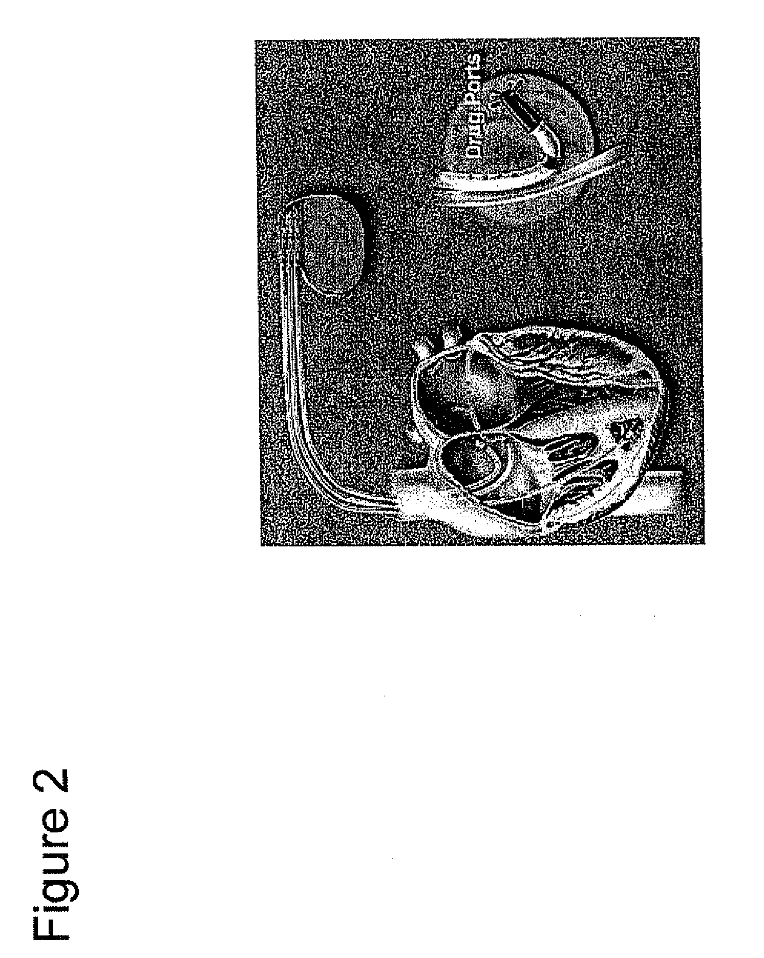 Method and apparatus for detection and treatment of autonomic system imbalance