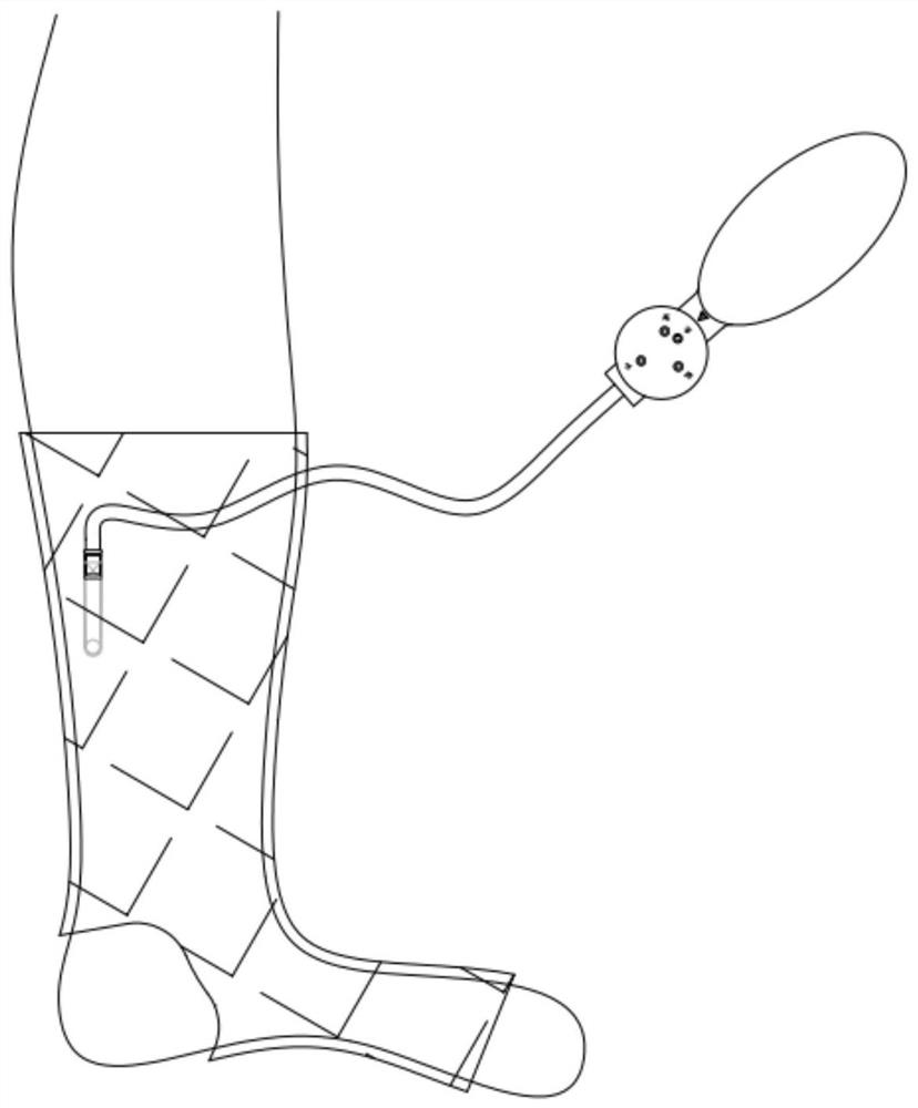 Compression system for the treatment of varicose veins of the lower extremities