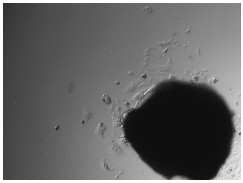 Primary hepatocyte isolation and culture method