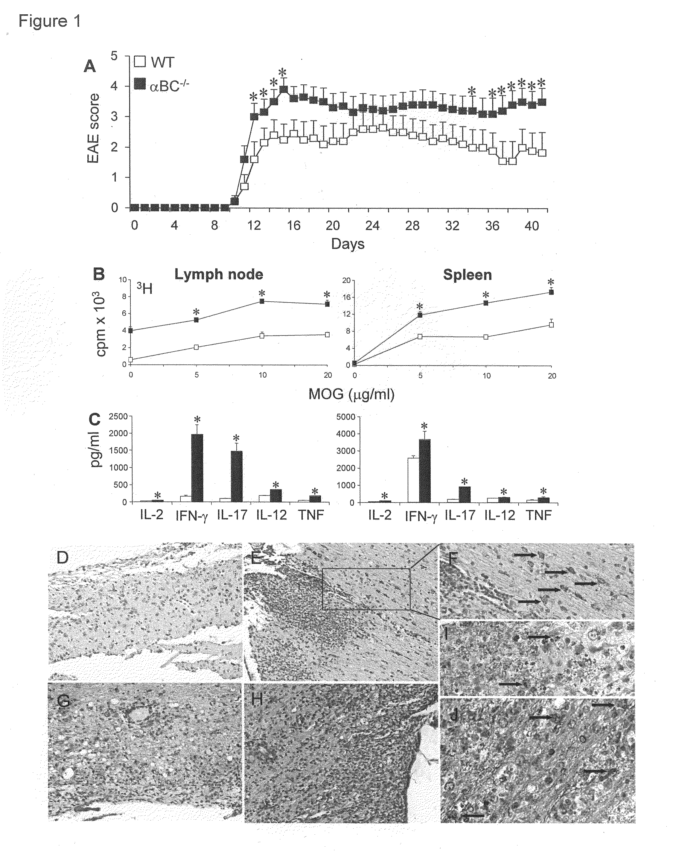 Alpha b-chrystallin as a therapy for inflammation