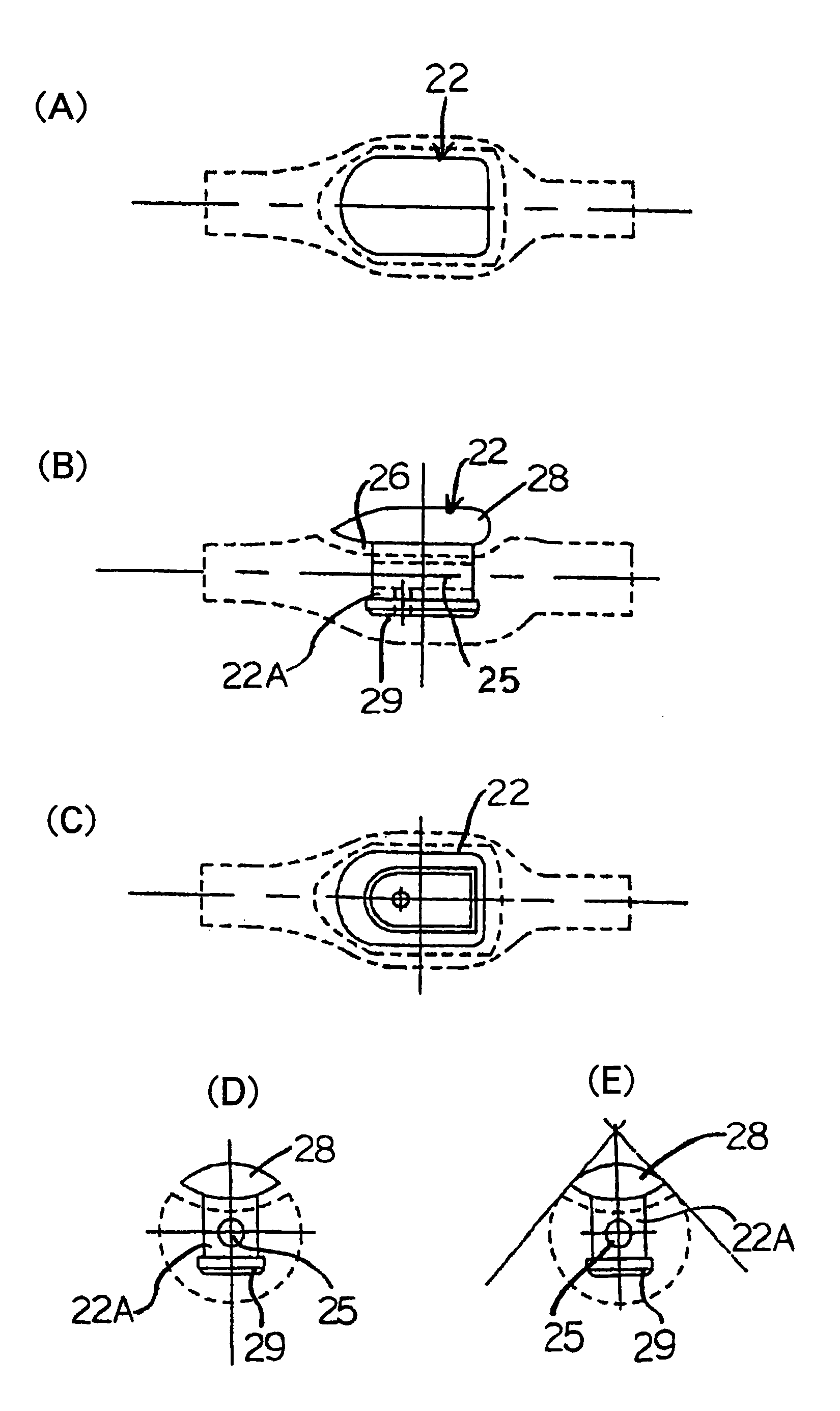 Stent graft indwelling device and fixed chip