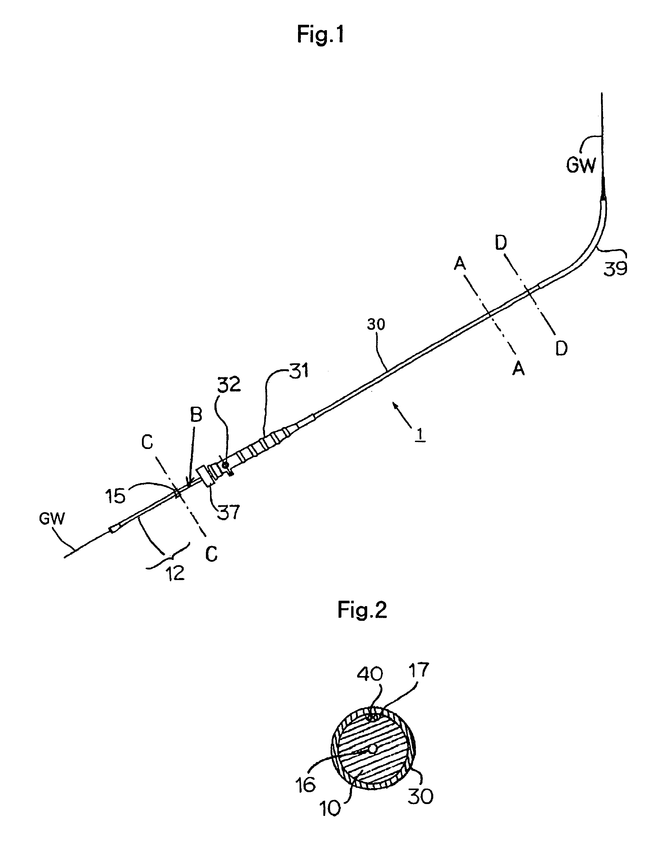 Stent graft indwelling device and fixed chip