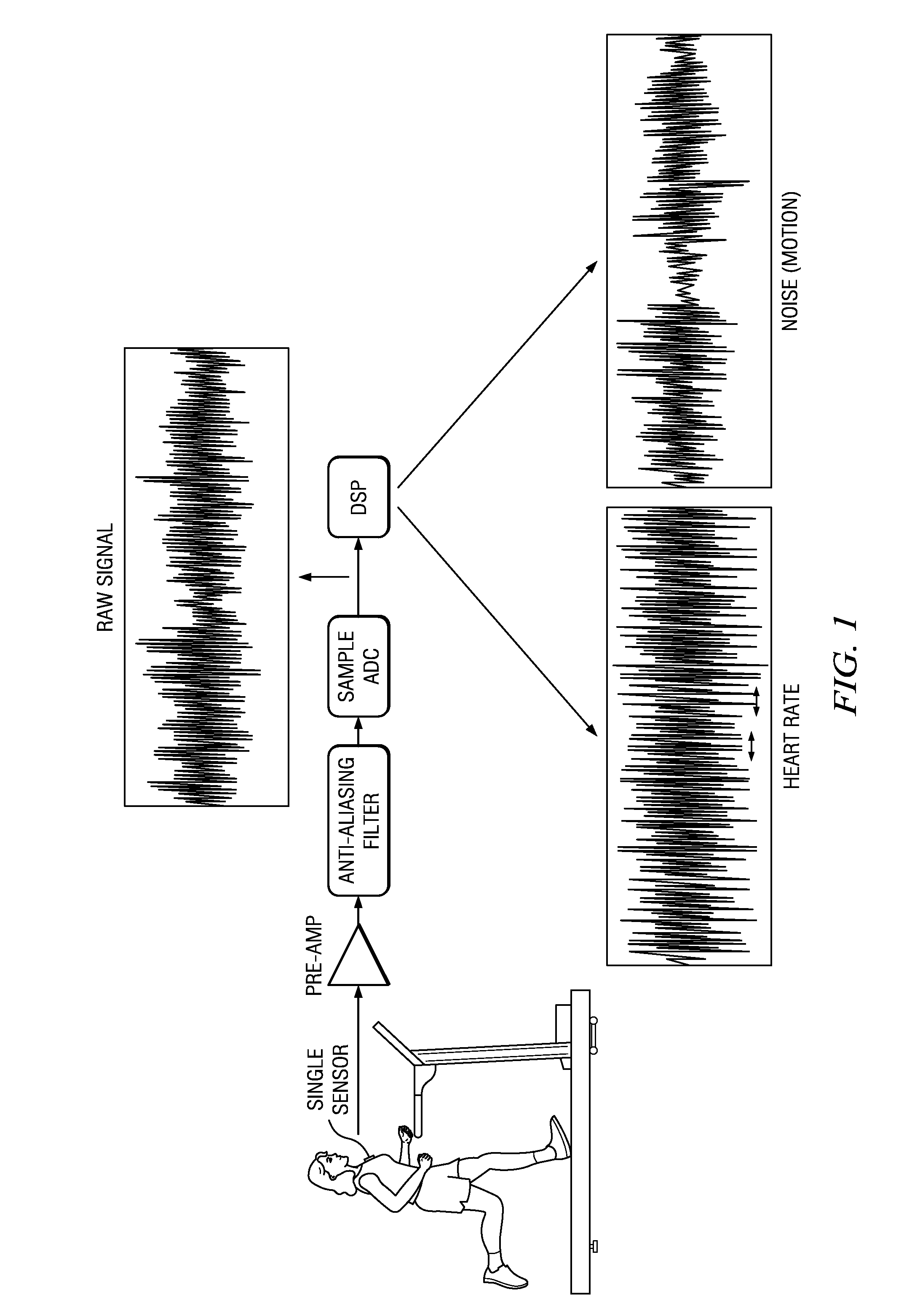Heart monitors and processes with accelerometer motion artifact cancellation, and other electronic systems