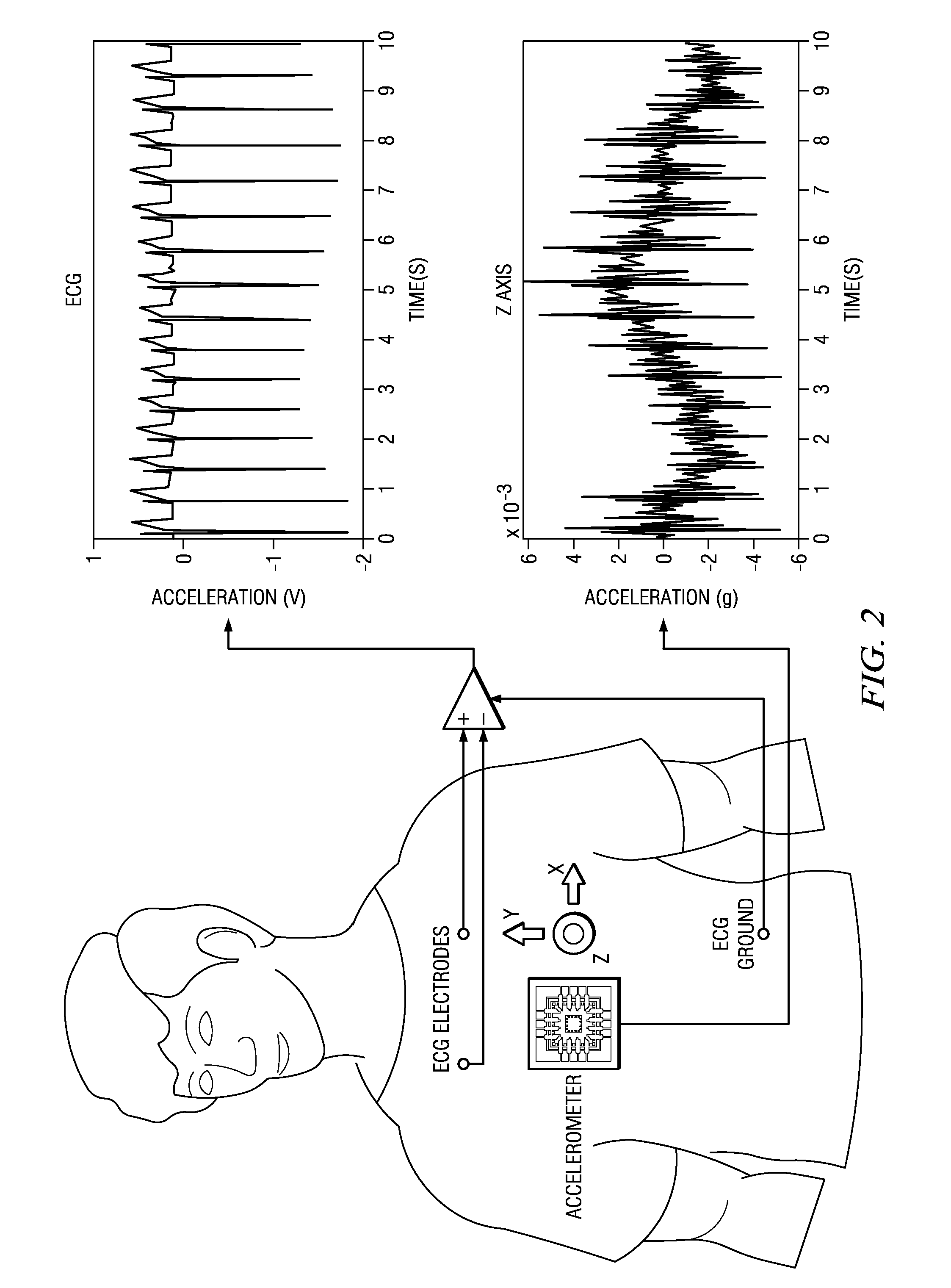 Heart monitors and processes with accelerometer motion artifact cancellation, and other electronic systems