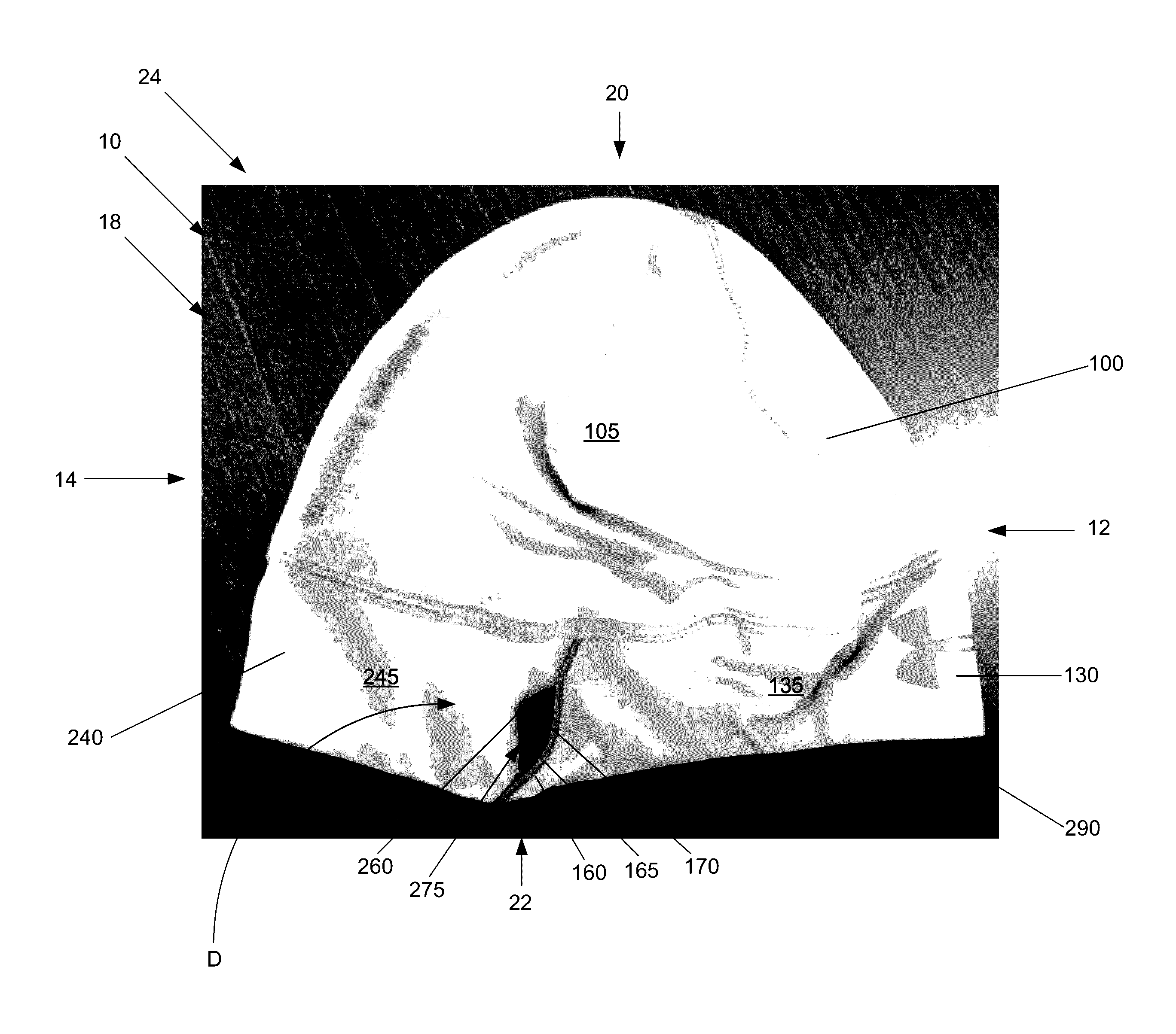 Headwear with pass-through slots