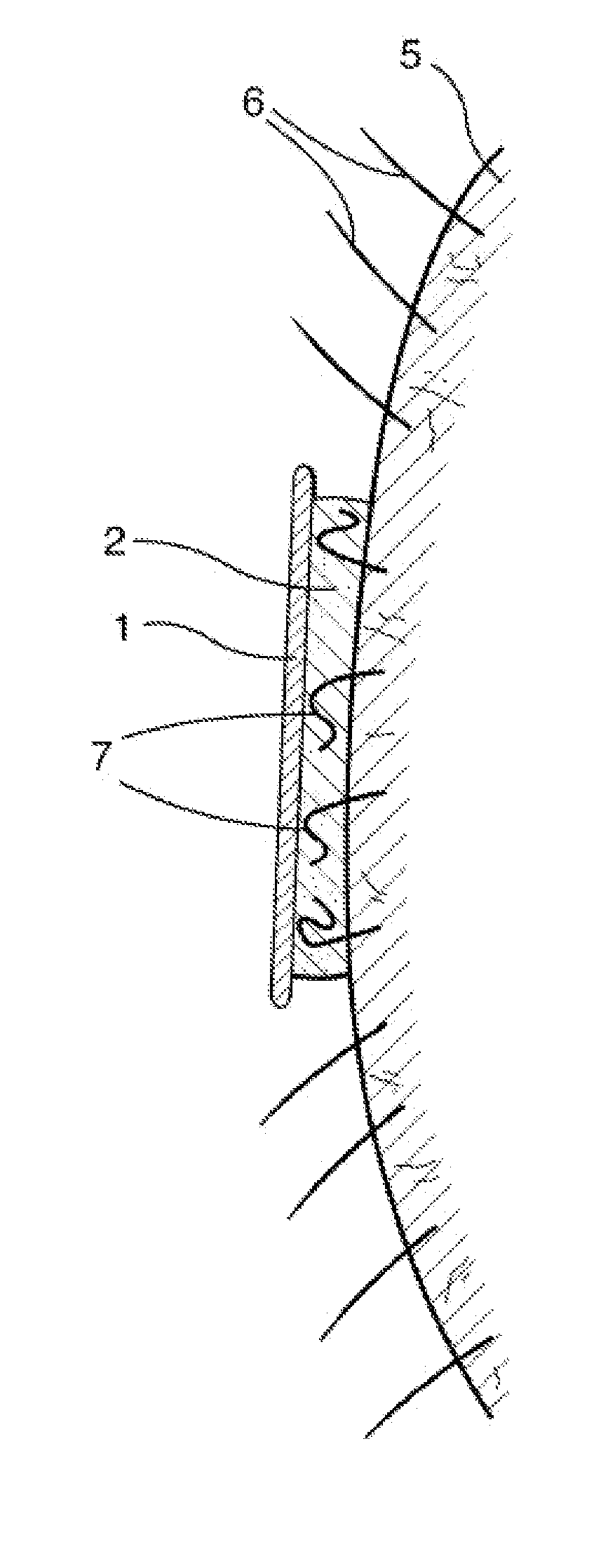 Tensionable Depilatory Article