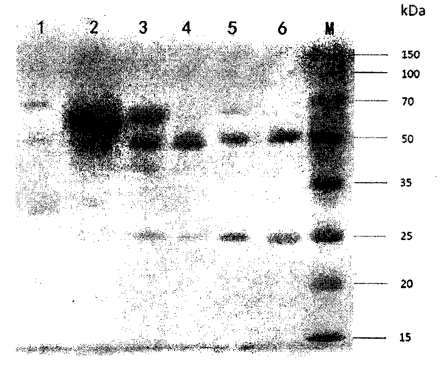 Monoclonal antibody resisting XOD (xanthine oxidase) and preparation method and application thereof