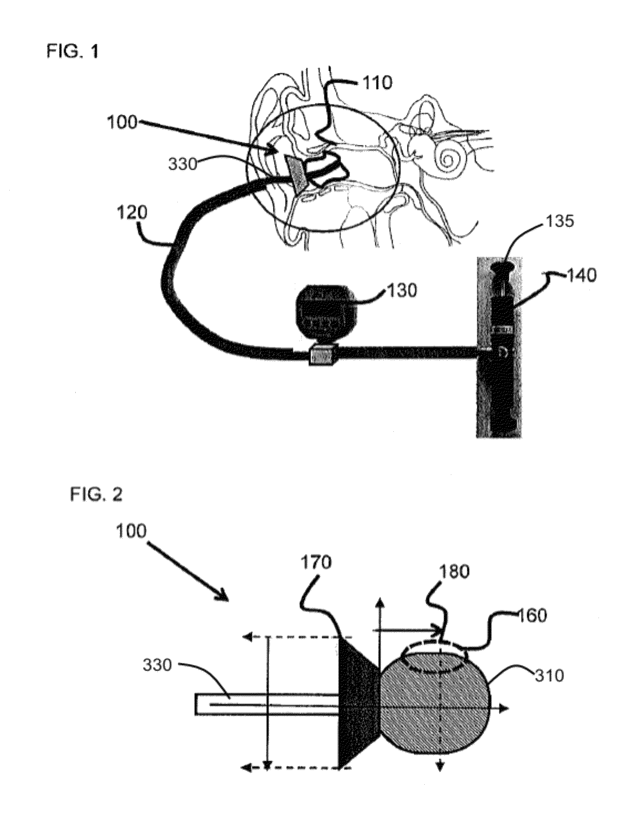 Device and method for radial pressure determination