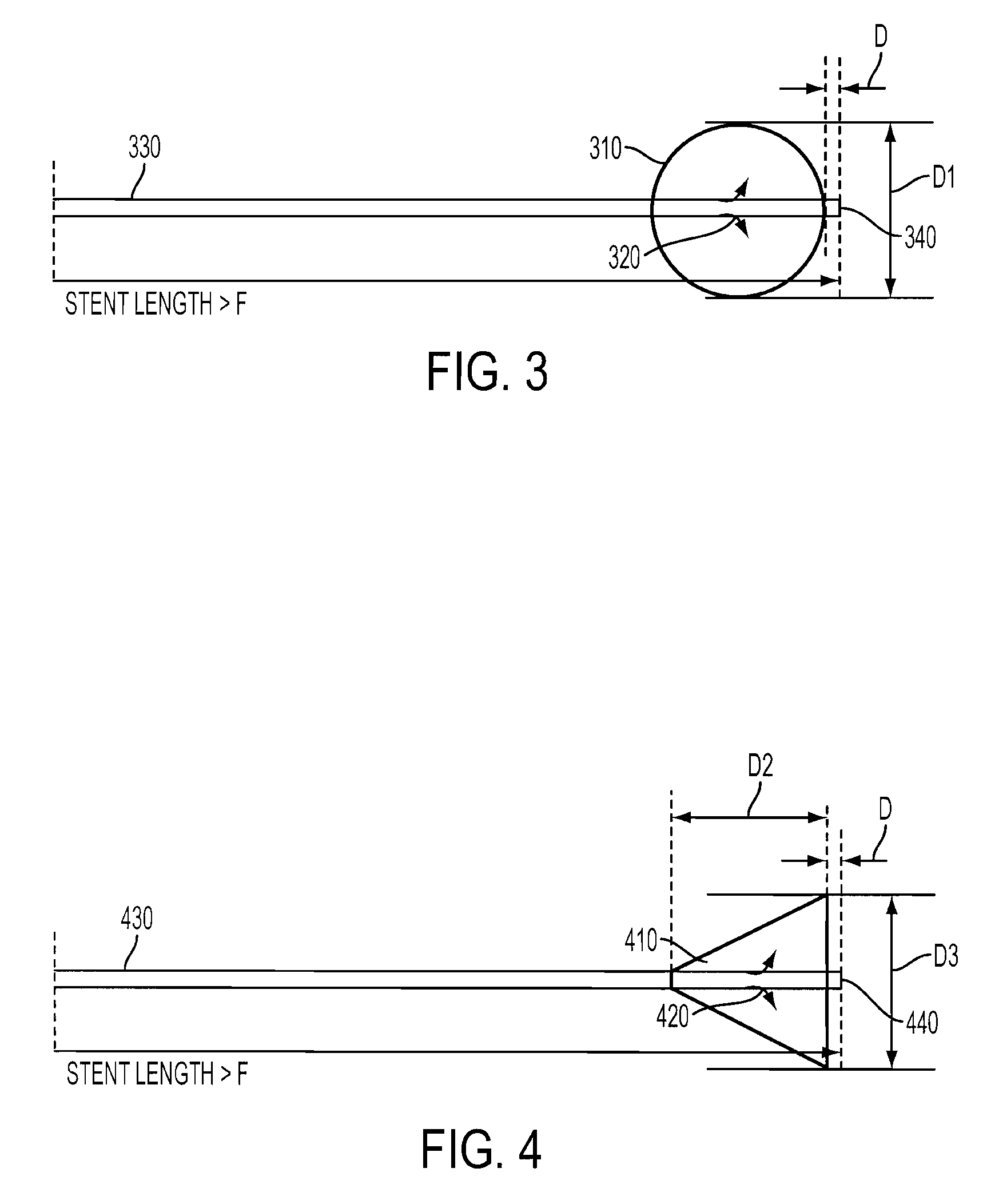 Device and method for radial pressure determination
