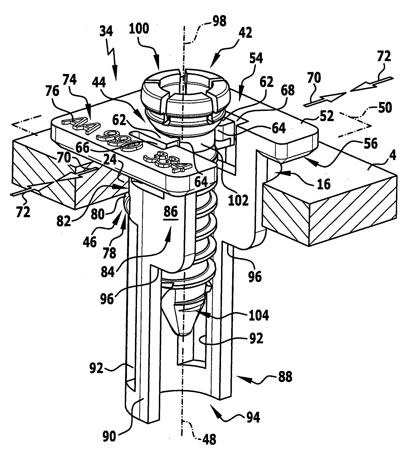 Holding device for an implant