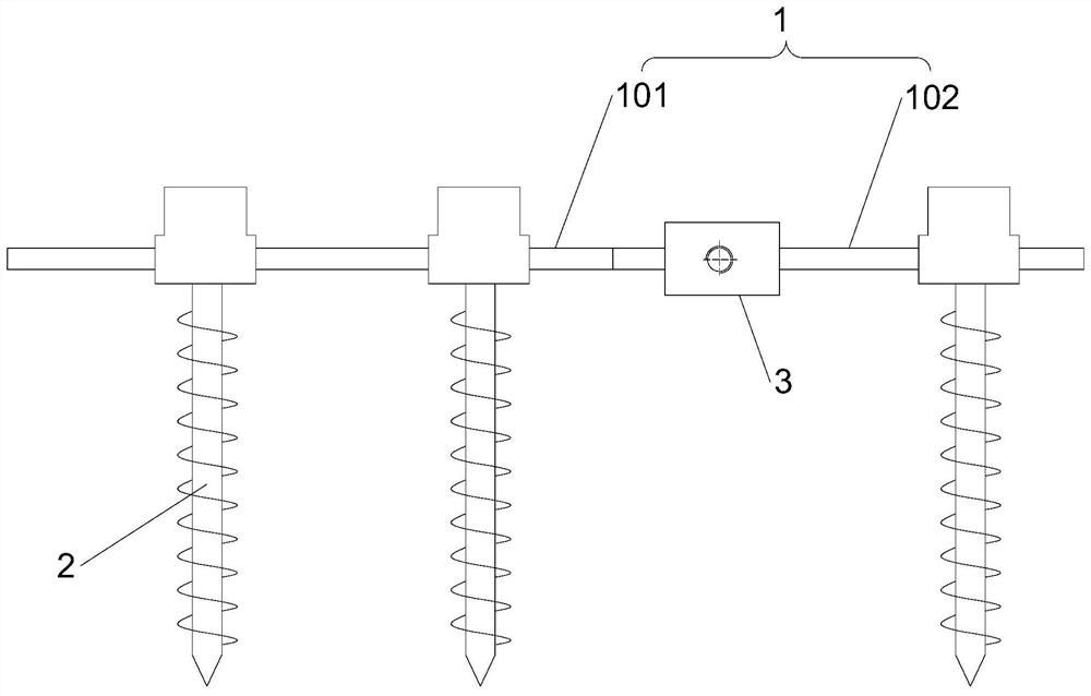 A reduction and fixation device for severe spondylolisthesis