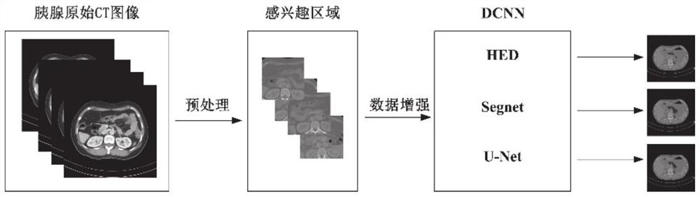 Pancreas segmentation method and system based on deep convolutional neural network