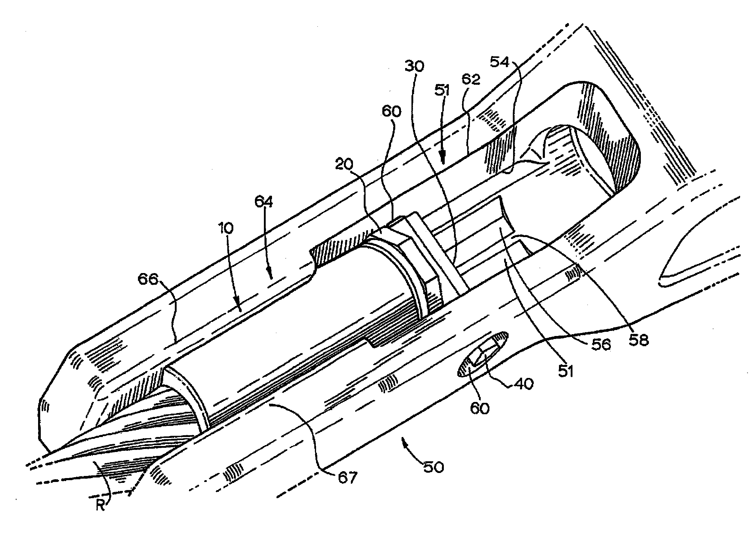 Ferrule retention