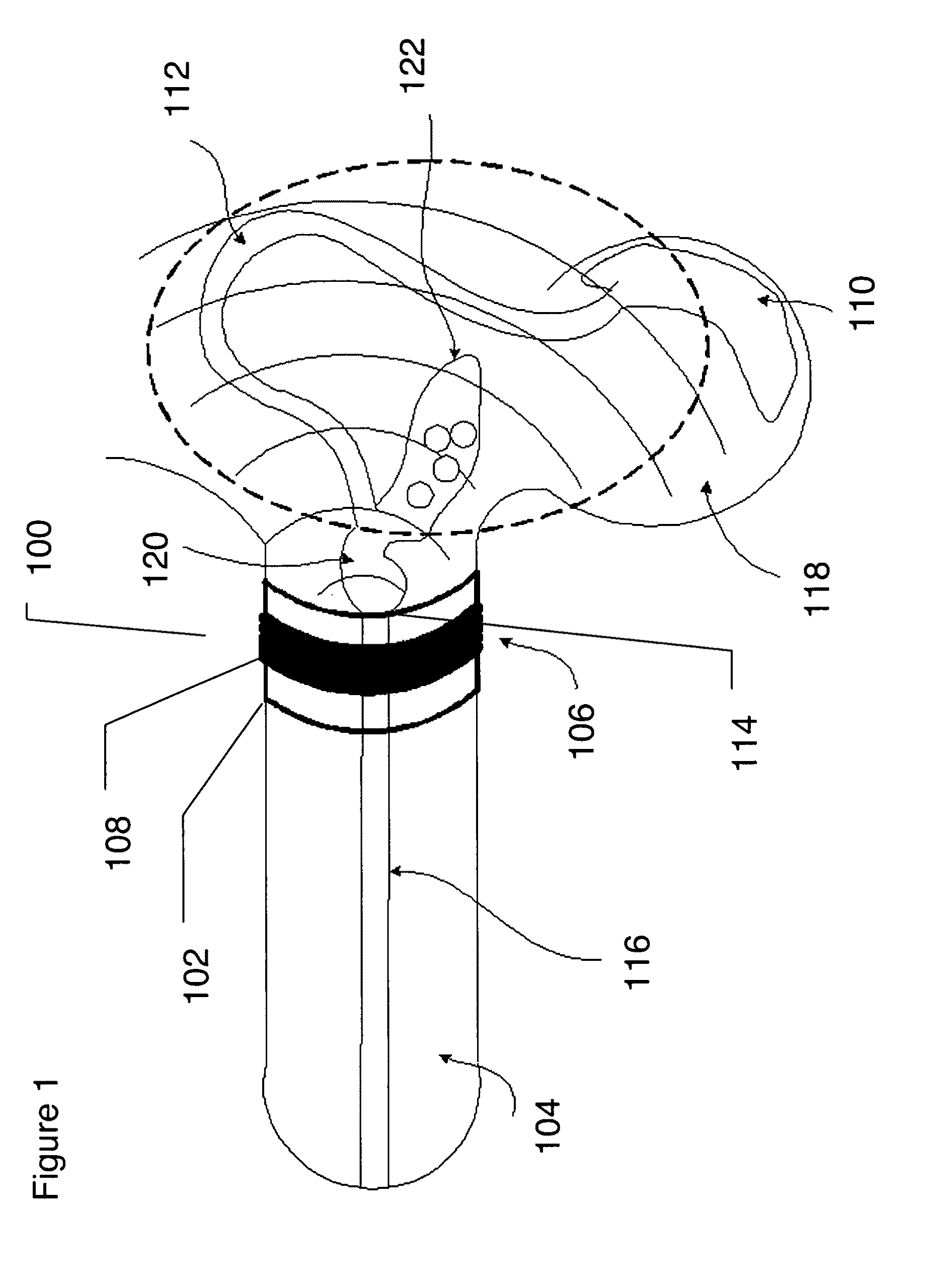Ultrasonic device for fertility control and management and navigation