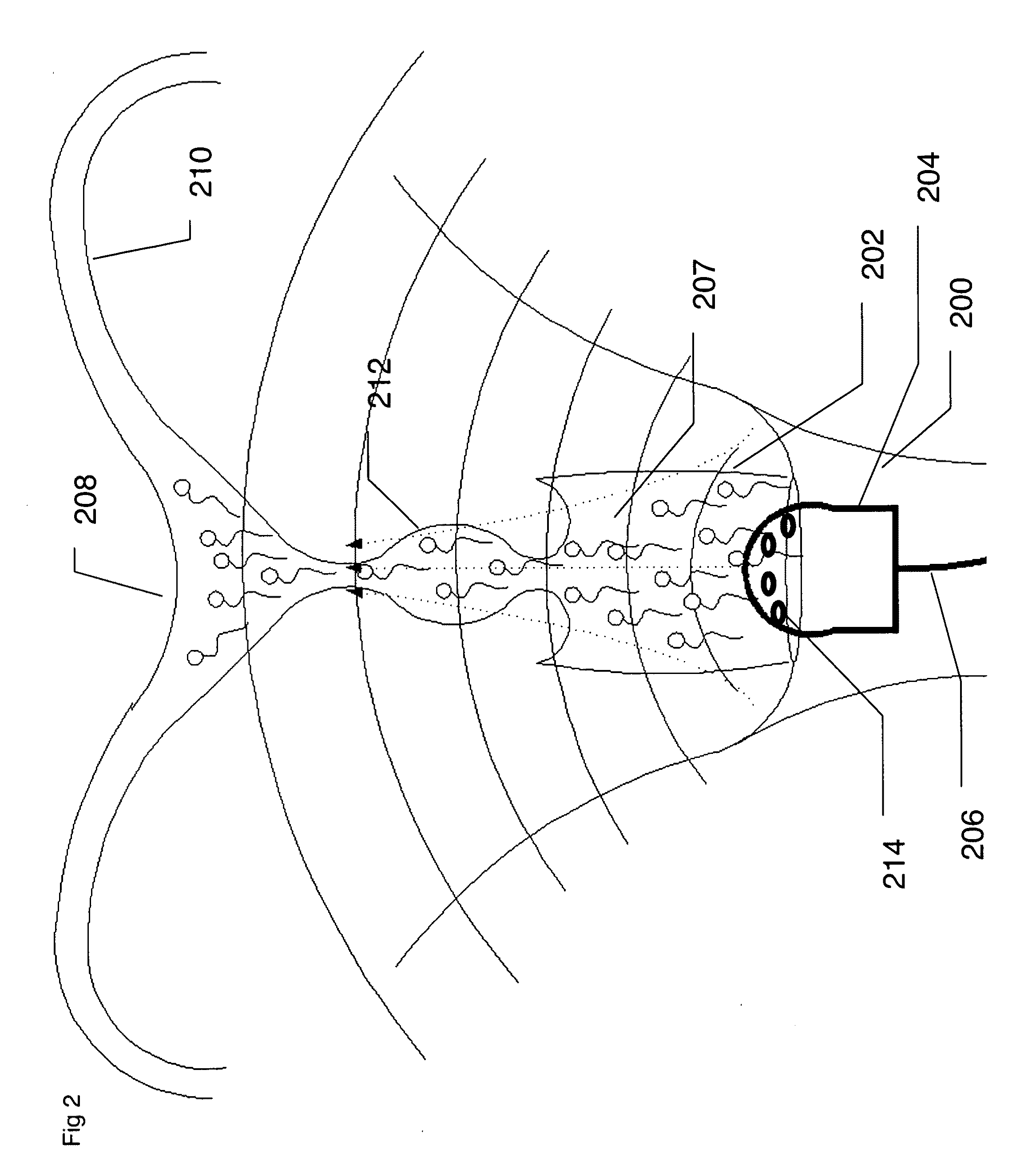 Ultrasonic device for fertility control and management and navigation