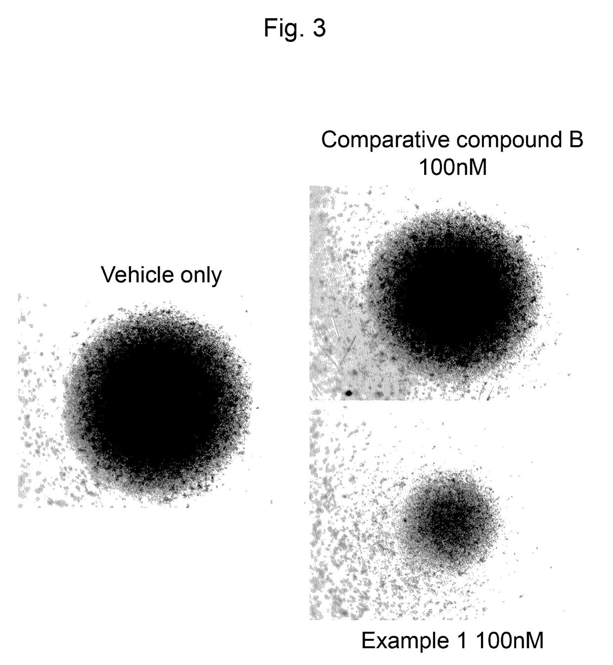 Agent for treating or inhibiting recurrence of acute myeloid leukemia