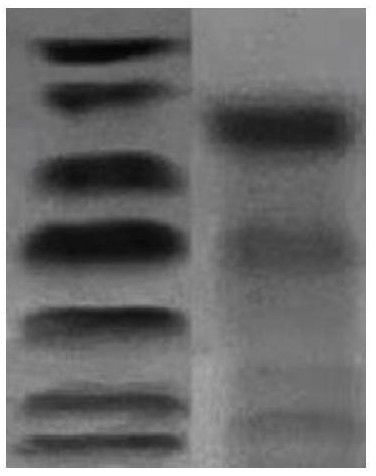 New application of highland barley cyanidin oxygen methyltransferase gene