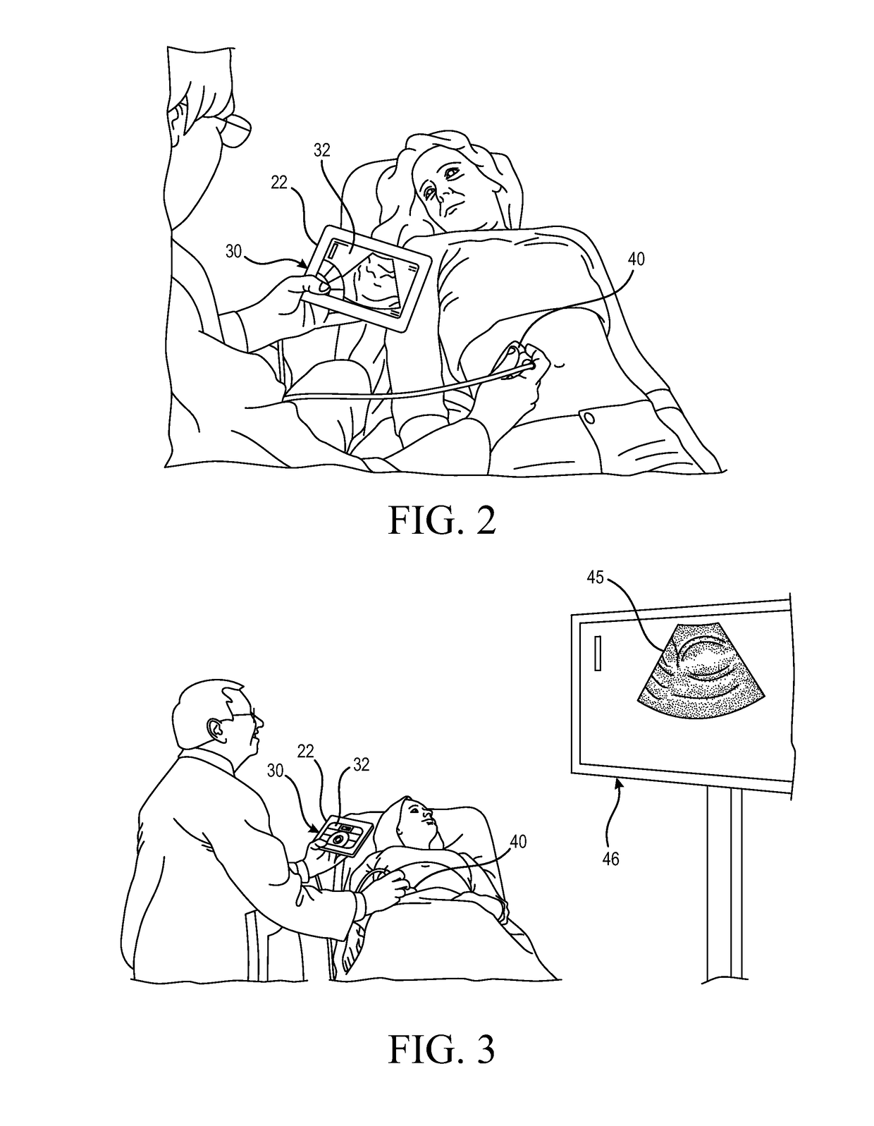 Dual display presentation apparatus for portable medical ultrasound scanning systems