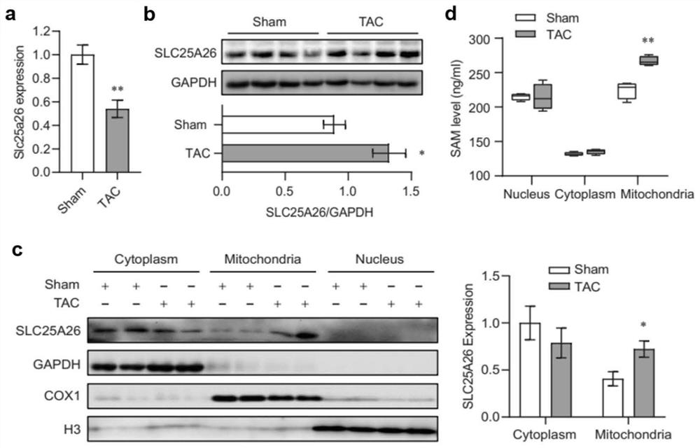 Application of SLC25A26 in preparation of medicine for inhibiting cardiac hypertrophy