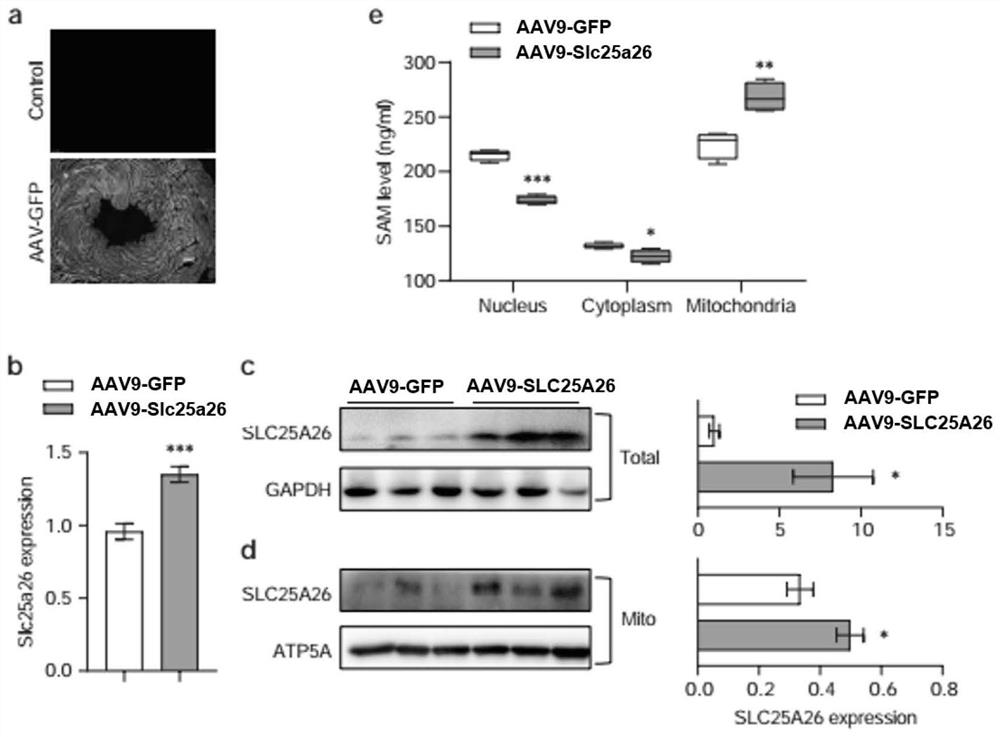 Application of SLC25A26 in preparation of medicine for inhibiting cardiac hypertrophy