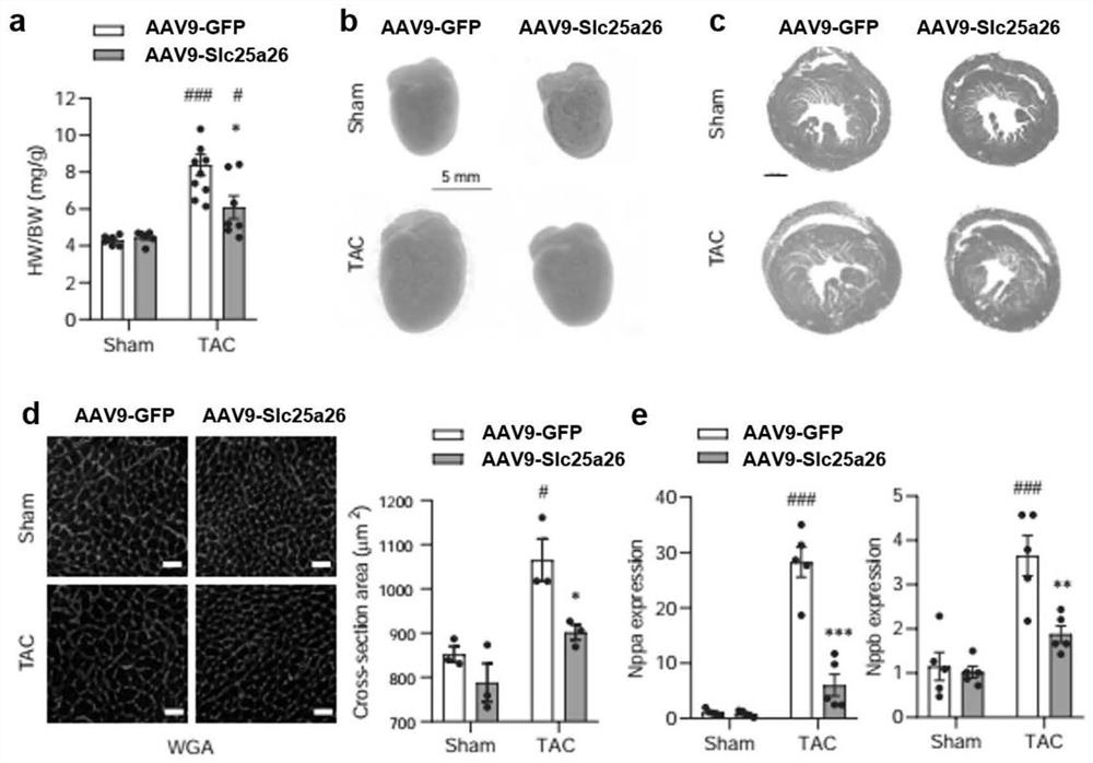 Application of SLC25A26 in preparation of medicine for inhibiting cardiac hypertrophy