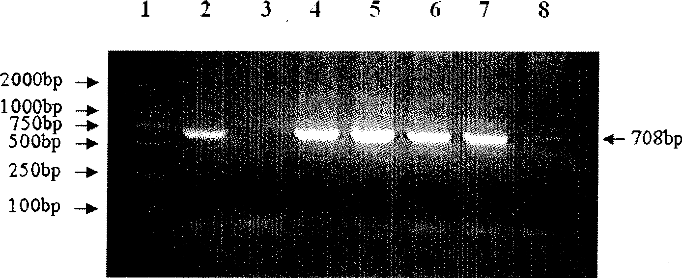 4 connecting body thymosin alpha 1 gene order and preparation method of transgene tomato